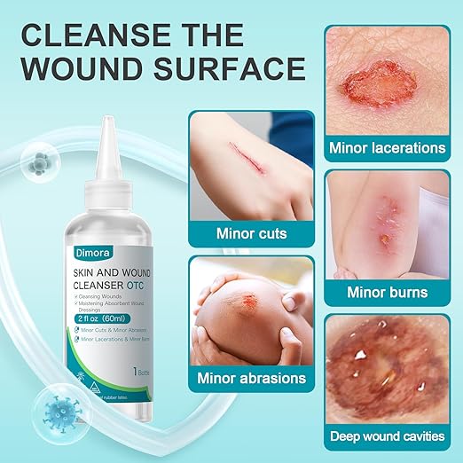 Dimora Portable First Aid Antiseptic Cleanser, OTC Antimicrobial Skin and Wound Cleanser for Cuts, Abrasions, Lacerations, Burns, Skin-Neutral pH – 3-Pack Travel Size, 60mL Each (6oz Total)